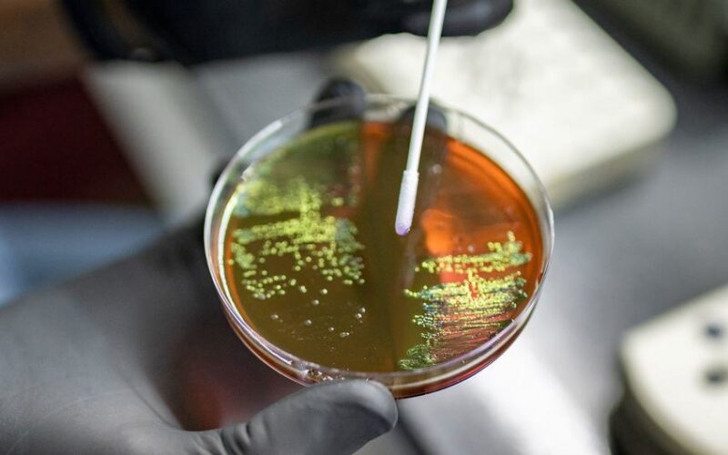 OMS atualiza lista de bactérias que mais ameaçam a saúde humana