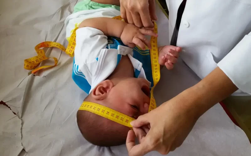 INSS pagará indenização de R$ 60 mil a crianças vítimas de zika