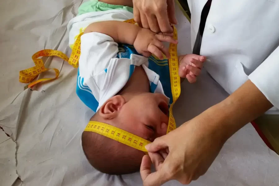 INSS pagará indenização de R$ 60 mil a crianças vítimas de zika