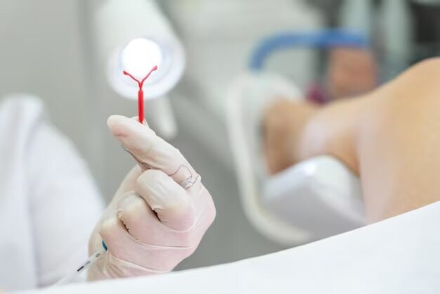 Planos de saúde terão que cobrir DIU hormonal em casos de endometriose
