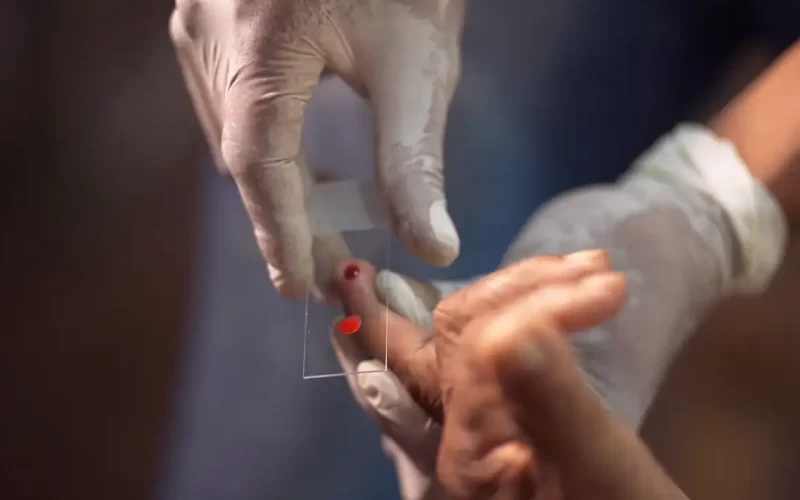 SUS começa a usar novo tratamento contra a malária em crianças