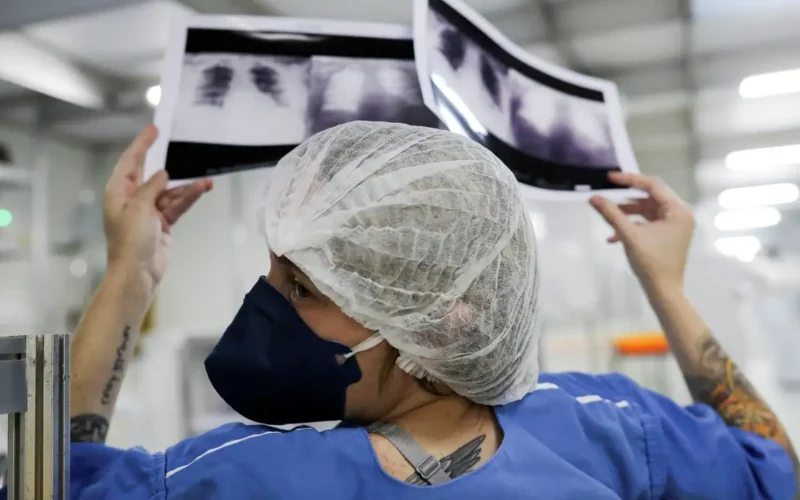 Câncer de pulmão é diagnosticado em estágio avançado em quase 90% dos casos analisados no SUS
