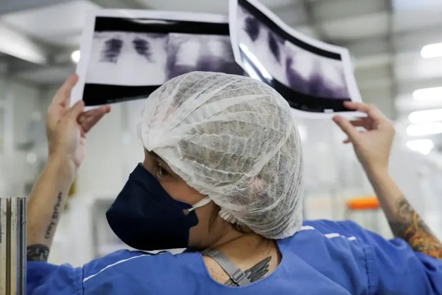 Câncer de pulmão é diagnosticado em estágio avançado em quase 90% dos casos analisados no SUS