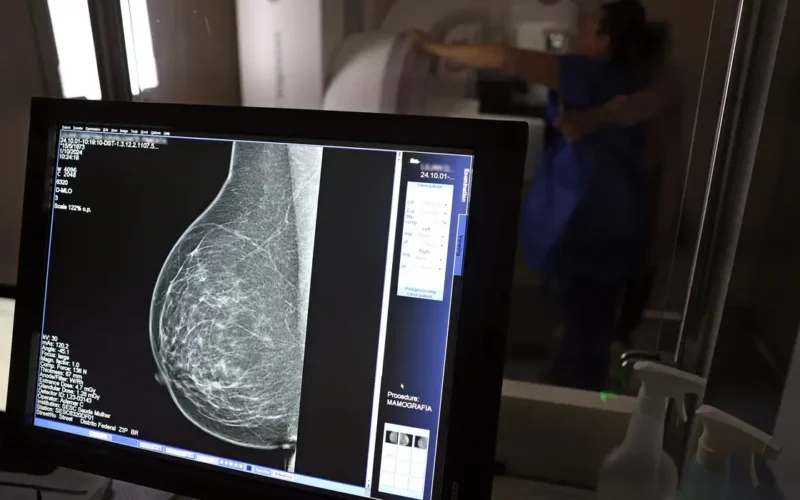 Médicos lançam guia para evitar recusa de mamografia digital