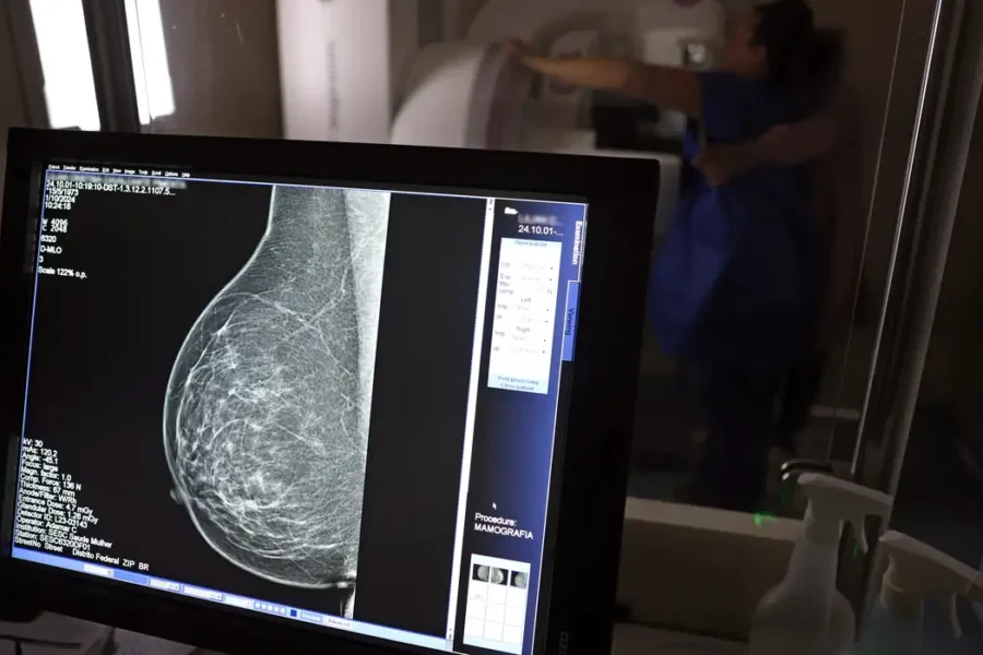 Médicos lançam guia para evitar recusa de mamografia digital